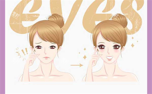 双眼皮手术前后对比图.jpg 双眼皮手术前后对比图.jpg