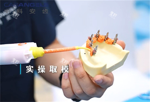 中科安齿种植牙实操取模.jpg 中科安齿种植牙实操取模.jpg