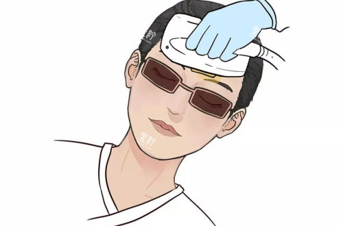 激光美白漫画示意图.jpg