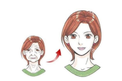 面部拉皮提升卡通对比图