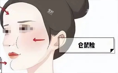玻尿酸后馒化现象动画展示.png