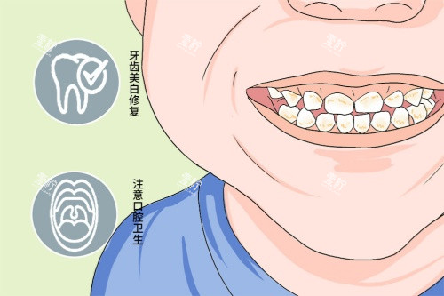 四环素牙卡通图.jpg