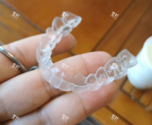 隐形牙齿矫正牙套图.png
