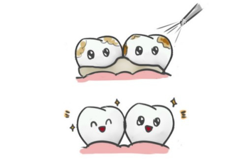 洗牙卡通图.jpg