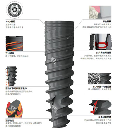 百齿泰泰锆3.0种植牙怎么样.jpg 百齿泰泰锆3.0种植牙怎么样.jpg
