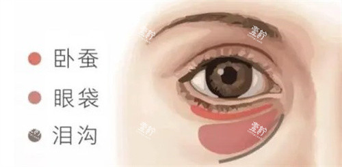卧蚕眼袋泪沟的区别.jpg
