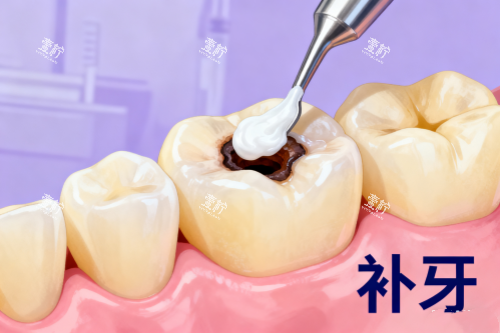 补牙卡通展示图.png
