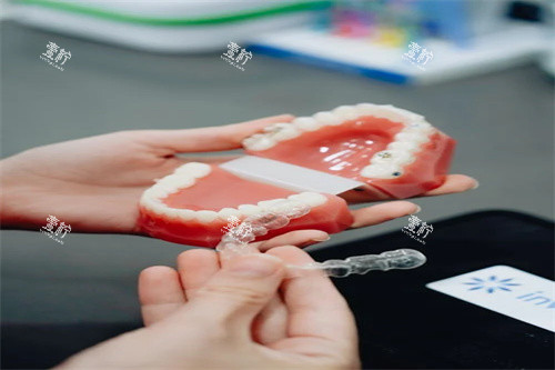 牙齿矫正宣传图.jpg
