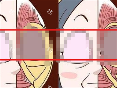 玻尿酸栓塞组织对比动画.png 玻尿酸栓塞组织对比动画.png