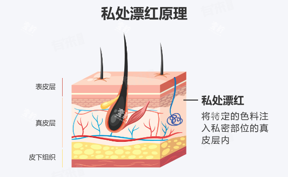 阴唇漂红原理.png 阴唇漂红原理.png