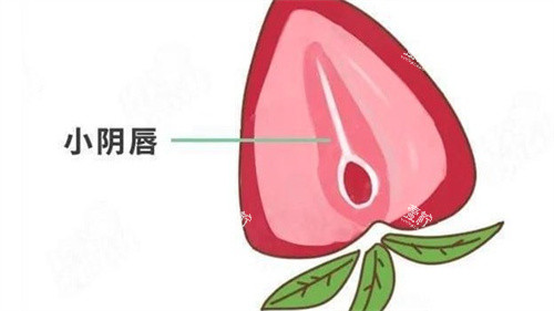 小阴唇整形.jpg 小阴唇整形.jpg
