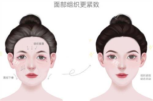 耳基底填充前后对比.jpg