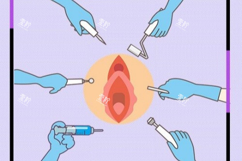 私密整形卡通图.jpg