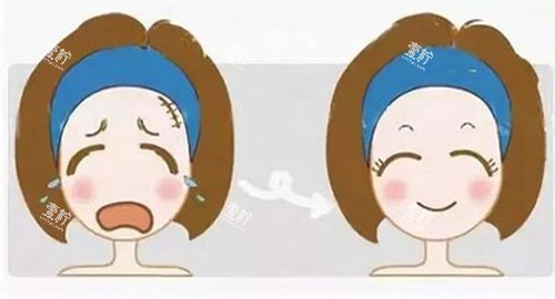 激光美容前后对比卡通示意图.jpg