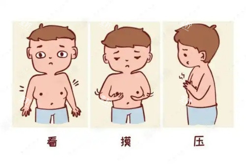 男性乳房发育吸脂前后对比图.jpg