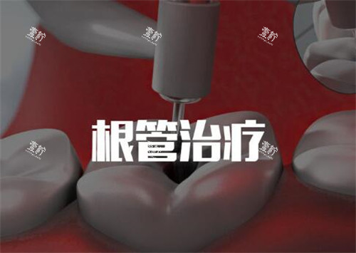 根管治疗卡通图.jpg 根管治疗卡通图.jpg