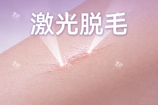 激光脱毛卡通展示图.jpg 激光脱毛卡通展示图.jpg