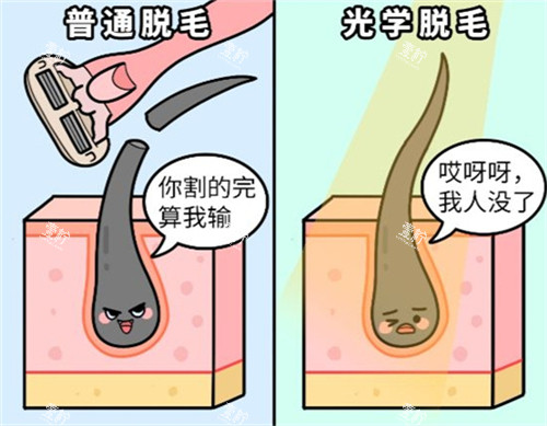 激光脱毛和普通刮毛的区别.jpg 激光脱毛和普通刮毛的区别.jpg