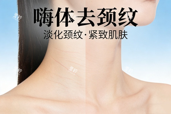 嗨体去颈纹卡通展示图.jpg 嗨体去颈纹卡通展示图.jpg