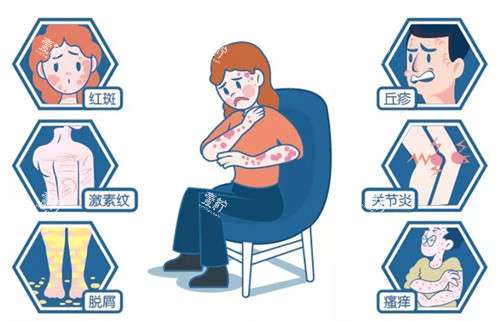 牛皮癣银屑病病症.jpg