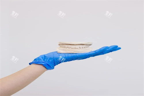 牙齿矫正示意展示.jpg 牙齿矫正示意展示.jpg