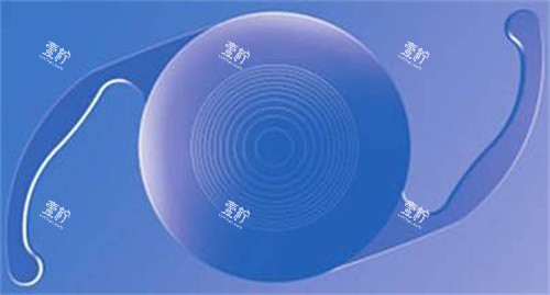 白内障晶体示意图展示.jpg