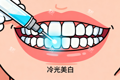 牙齿冷光美白卡通图.png 牙齿冷光美白卡通图.png