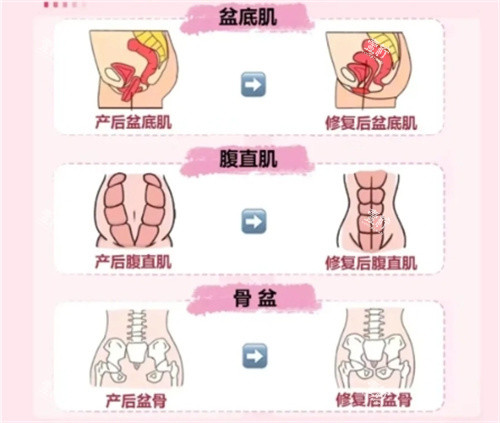 产后修复要做的项目.jpg 产后修复要做的项目.jpg