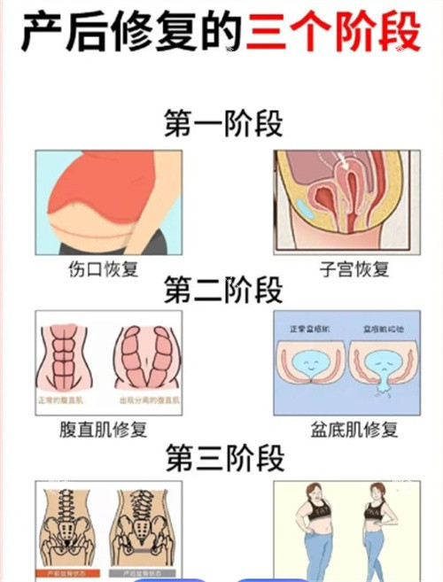 产后修复的三个阶段.jpg 产后修复的三个阶段.jpg