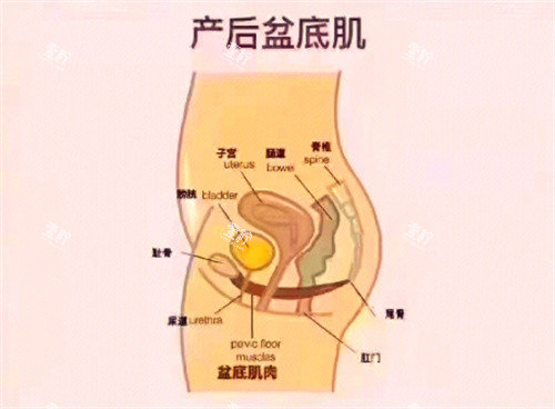 产后盆底肌.jpg 产后盆底肌.jpg