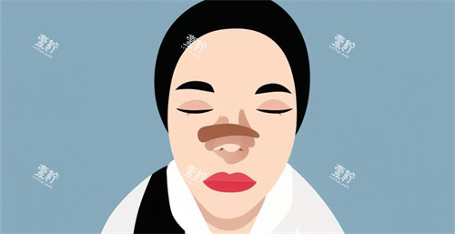 隆鼻手术后肿胀动画.jpg