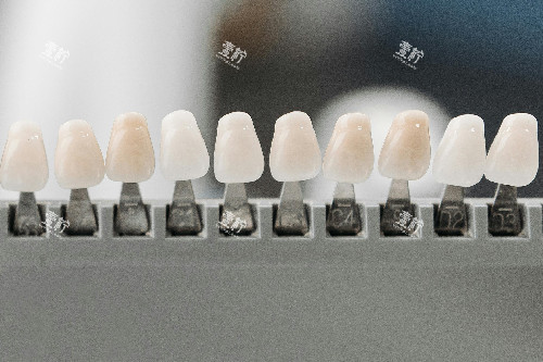 牙齿贴面色号.jpg