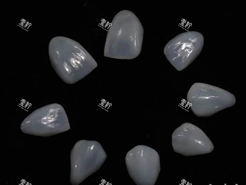 牙齿贴面照片.jpg