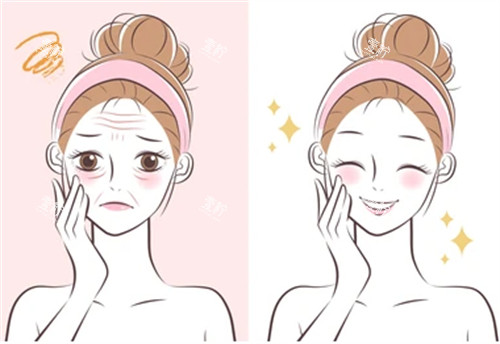 抗衰管理前后的对比图片.jpg
