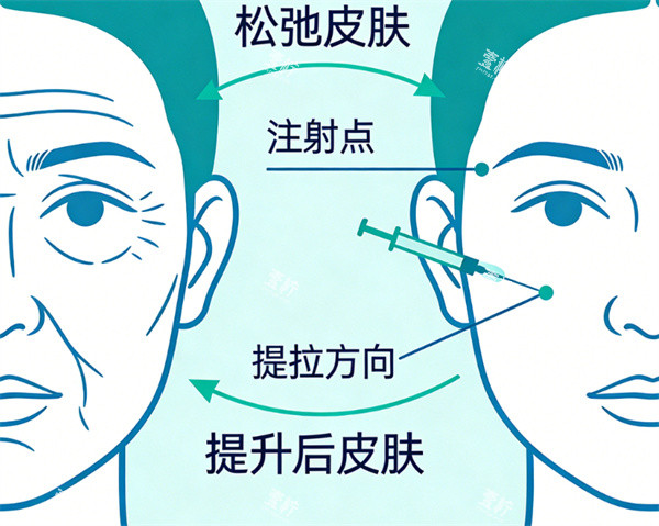 ***紧致卡通图.jpg ***紧致卡通图.jpg