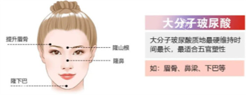 大分子玻尿酸简介.jpg