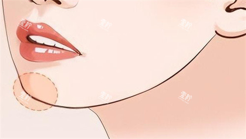 下巴填充对比 卡通.jpg
