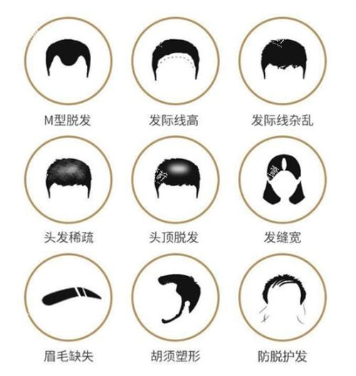 各种需要植发的情况图.png 各种需要植发的情况图.png