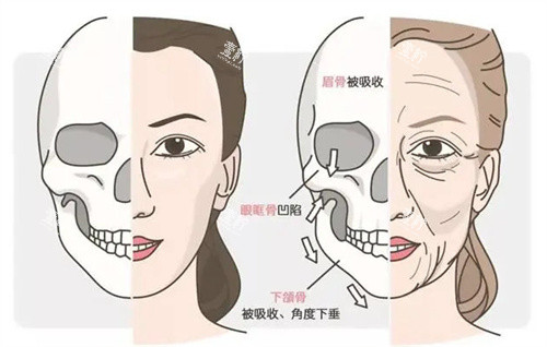 年轻和老化的面部骨骼.jpg