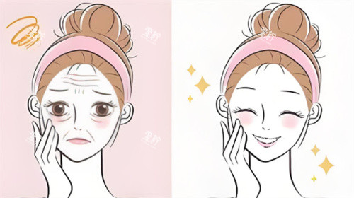 脸部抗衰对比.jpg