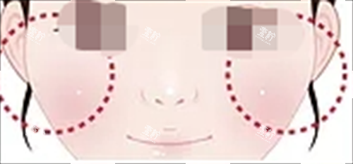 玻尿酸填充眼下填充.png
